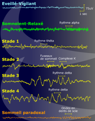 ondes cerebrales Problématique des ondes électromagnétiques