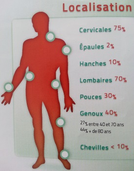 Arthrite - Rhumatismes inflammatoires - Arthrose - Rhumatismes ...