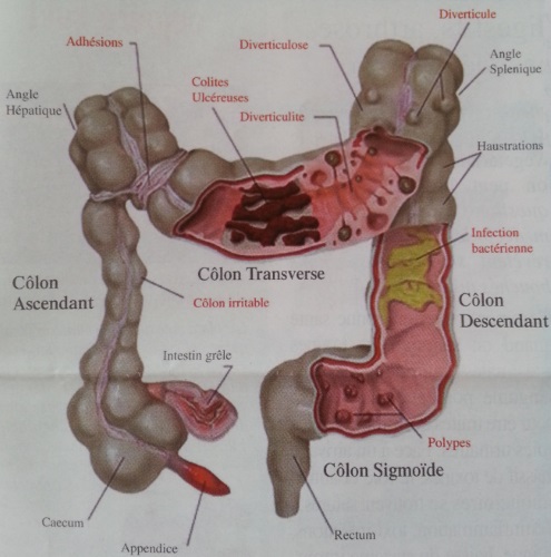 cure-detoxination-automne-detox-poumons-colon-gros-intestin-panier-bien-etre-st-pol-leon-finistere-4